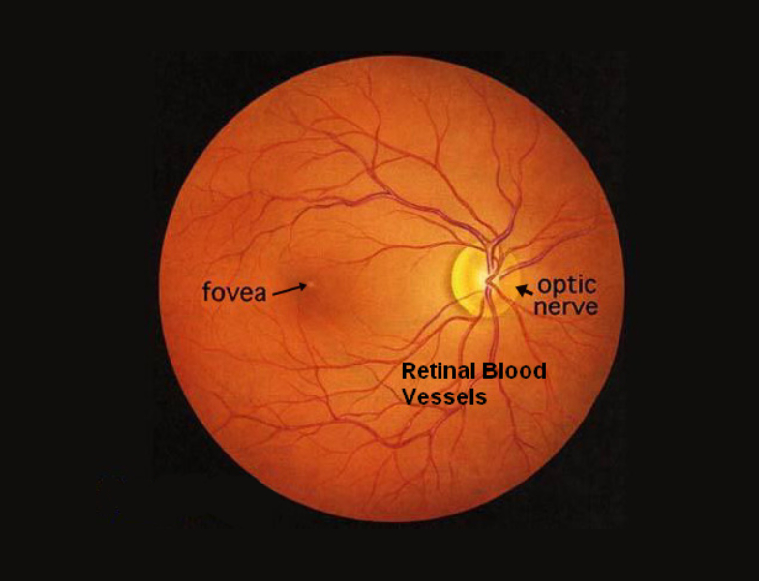 retina-treatment